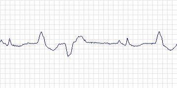 Electrocardiogram for ANSI/AAMI EC13 Test Waveforms, record aami3d