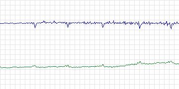 Electrocardiogram for MIT-BIH Atrial Fibrillation, record 07859