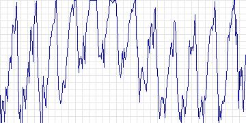 Electrocardiogram for Creighton University Ventricular Tachyarrhythmia, record cu21