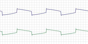 Electrocardiogram for MIT-BIH Normal Sinus Rhythm, record 19090