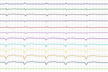 s0018cre-patient113 thumbnail