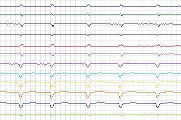 s0018lre-patient113 thumbnail