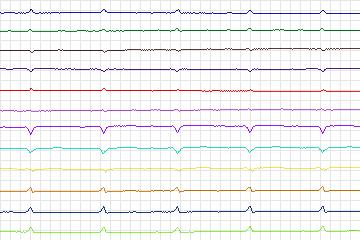 s0189_re-patient129 thumbnail