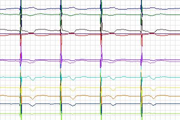 s0205_re-patient136 thumbnail