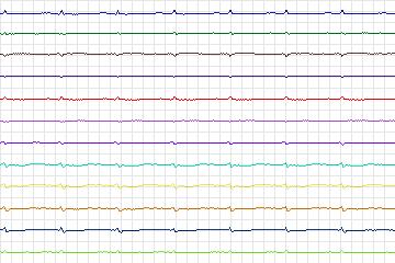 s0227lre-patient067 thumbnail