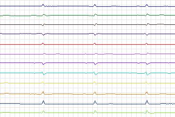 s0231lre-patient066 thumbnail