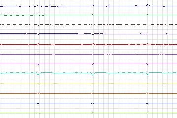 s0238lre-patient073 thumbnail