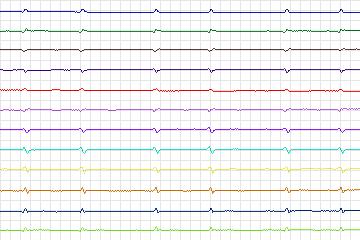 s0239lre-patient074 thumbnail