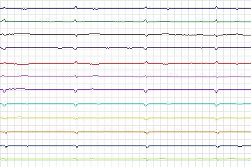 s0243lre-patient073 thumbnail