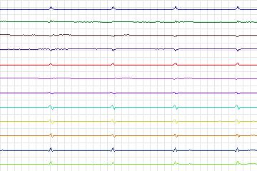 s0245lre-patient074 thumbnail