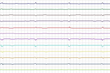 s0249lre-patient073 thumbnail