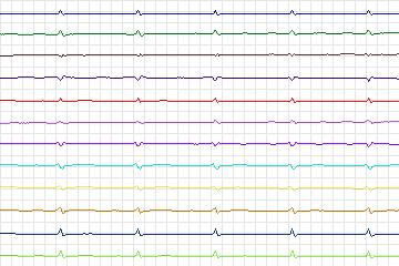 s0273lre-patient131 thumbnail