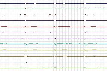 s0362lre-patient092 thumbnail