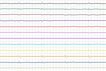 s0367lre-patient093 thumbnail