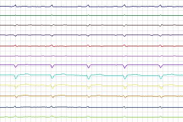 s0379lre-patient096 thumbnail