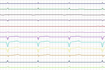 s0383lre-patient127 thumbnail