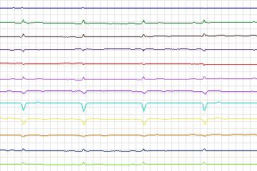 s0388lre-patient099 thumbnail