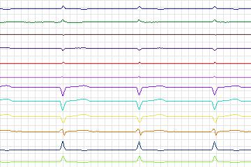 s0392lre-patient137 thumbnail