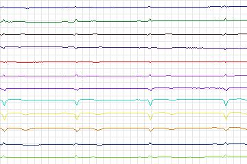 s0397lre-patient099 thumbnail