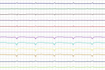 s0400lre-patient101 thumbnail