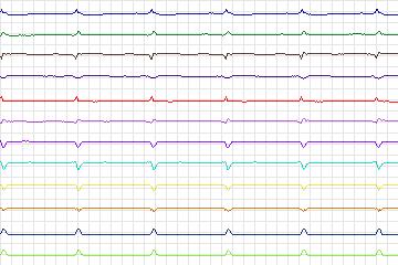 s0407lre-patient100 thumbnail