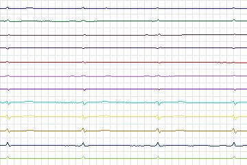 s0411lre-patient092 thumbnail