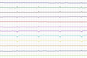 s0419lre-patient099 thumbnail