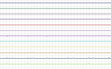 Electrocardiogram for T-Wave Alternans Challenge, record twa17