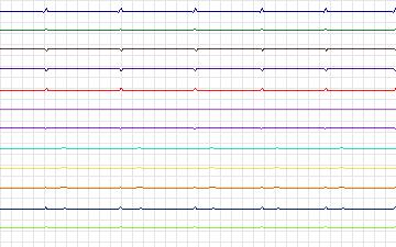 Electrocardiogram for T-Wave Alternans Challenge, record twa70