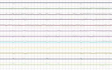 Electrocardiogram for T-Wave Alternans Challenge, record twa75