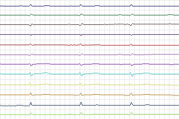 s0280lre-patient066 thumbnail